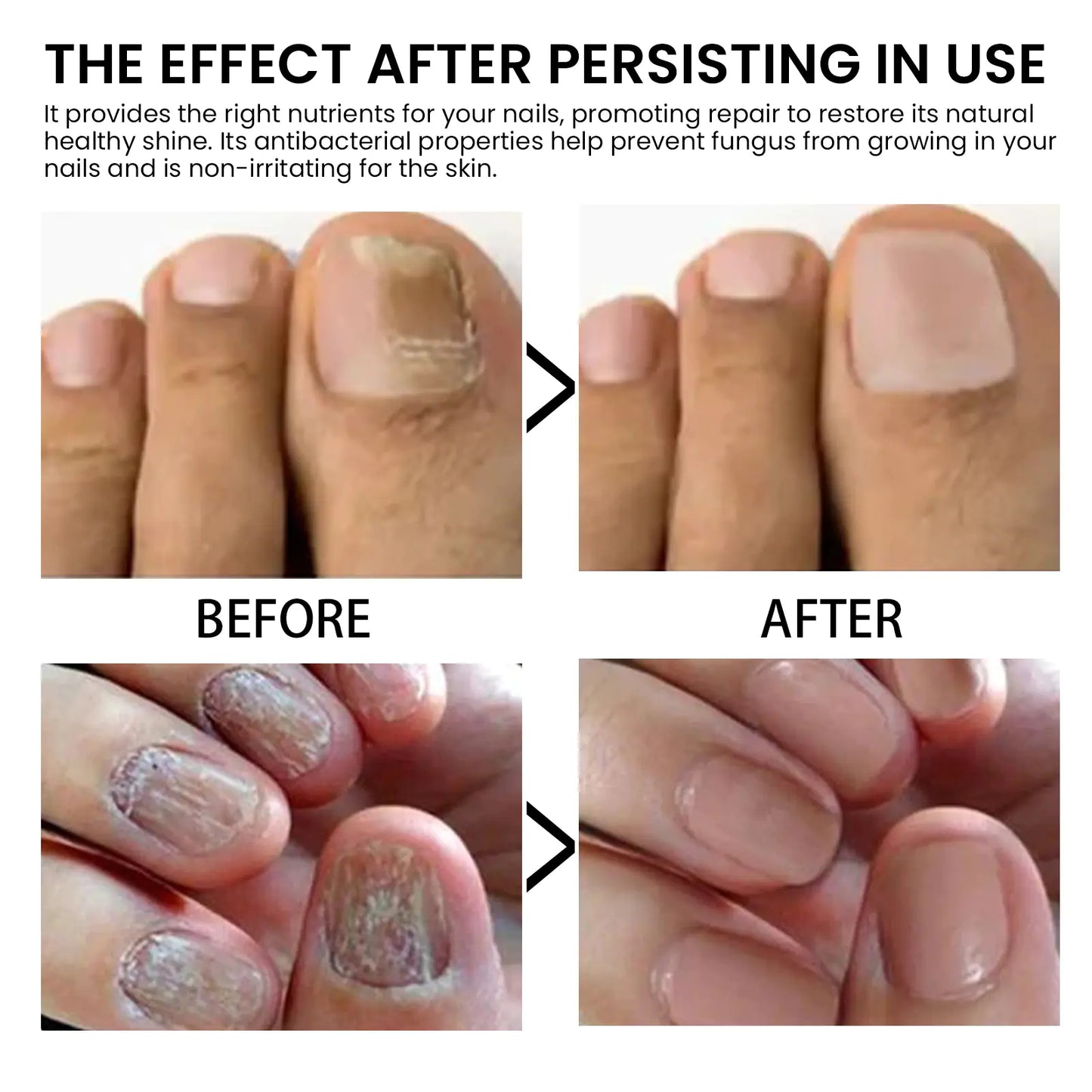 West&Month Nail Strengthening Oil for Healthy Nails